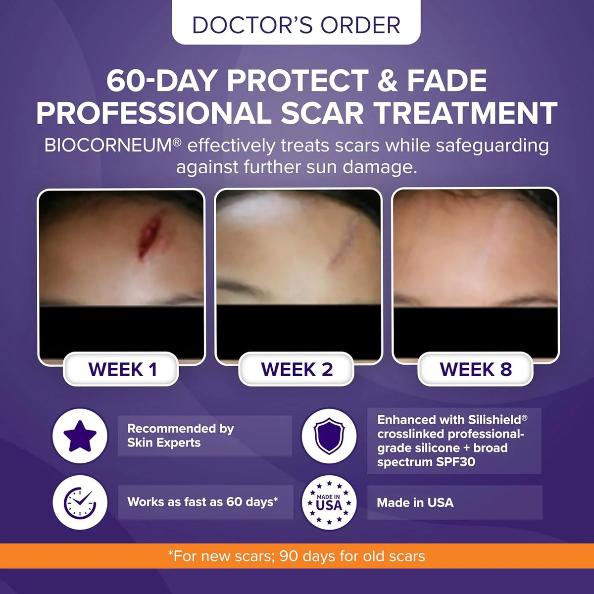 Biocorneum Advanced Scar Treatment