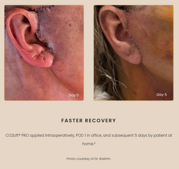 CO2 Lift Pro (Carboxy Gel) 3 pack